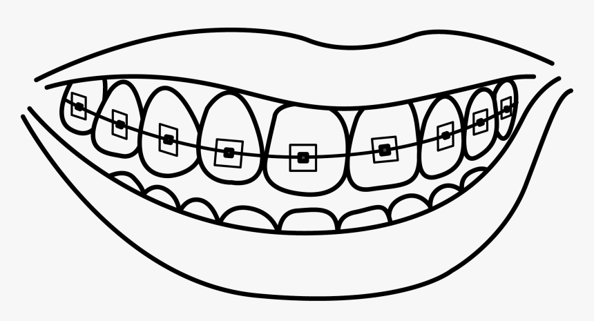 Collection Of With - Teeth With Braces Coloring Pages, HD Png Download ,  Transparent Png Image - PNGitem